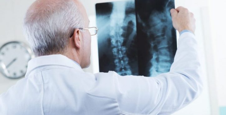 osteoporose-uma-doenca-silenciosa-e-cheia-de-riscos