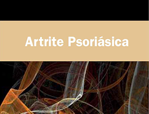 artrite-psoriasica