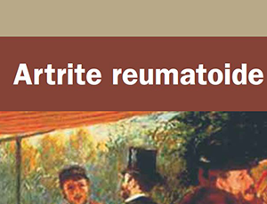 artrite-reumatoide