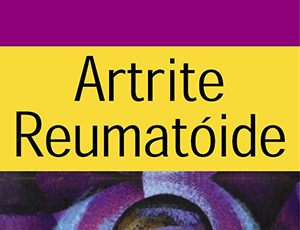 artrite-reumatoide-2