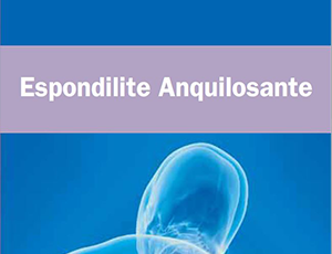 espondilite-anquilosante