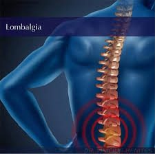 lombalgia-hernia-de-disco-ciatica