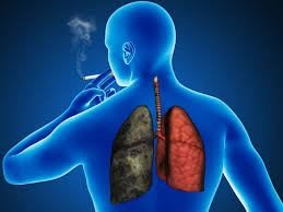 fumar-causa-reumatismo