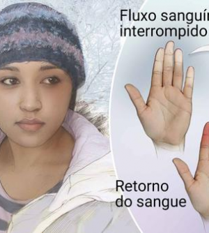 voce-sabe-o-que-e-fenomeno-de-raynaud