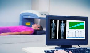 densitometria-ossea-informacoes-uteis