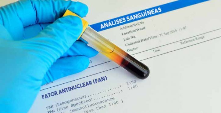 fan-positivo-tenho-lupus