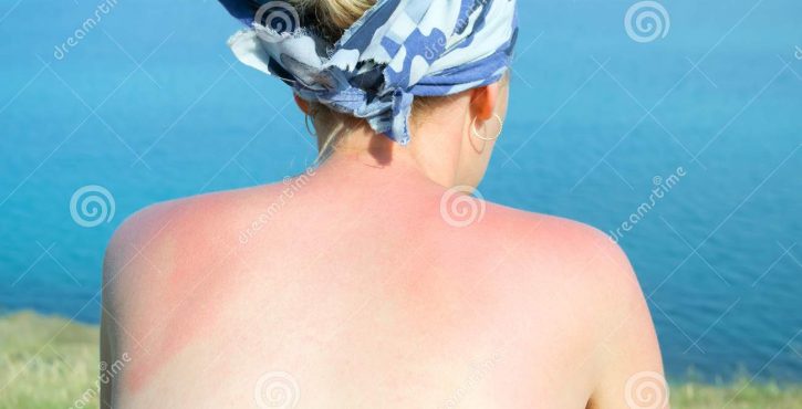 com-a-chegada-do-verao-e-bom-lembrar-de-redobrar-os-cuidados-com-o-sol